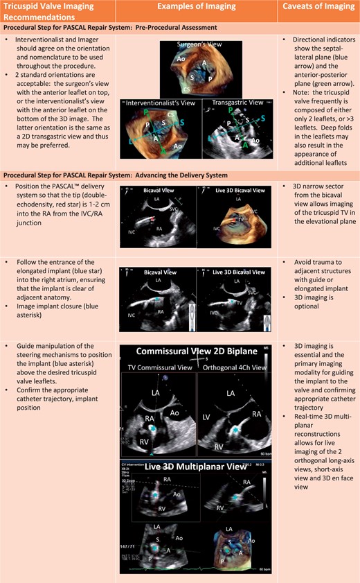Procedural steps for PASCAL tricuspid device implantation. (A) The imaging requires for pre-device assessment, advancing the delivery system (2D and 3D guidance) and positioning and orientating the device below the leaflets. (B) The next steps of clasping the leaflets and pre-delivery assessment. (C) The imaging necessary for post-implant assessment of tricuspid valve function as well as haemodynamic benefit.