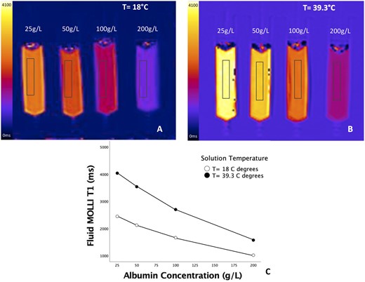 Relationship of fluid T1 and protein levels in phantom. Measured T1 values decreased with increasing albumin concentration in phantom both at room temperature (A) and at 39.3° (B), with a close correlation (r = − 0.992, p = 0.008 at 39.3°C) (C).