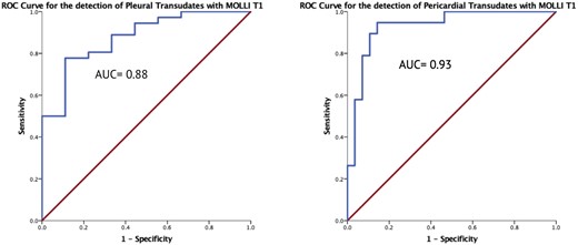 ROC curves for fluid T1 mapping. T1 values had very good diagnostic accuracy for discriminating transudates from exudates in pleural fluid using a cut-off T1 value of 3440 ms, and excellent accuracy for pericardial fluid using a cut-off of 3015 ms.