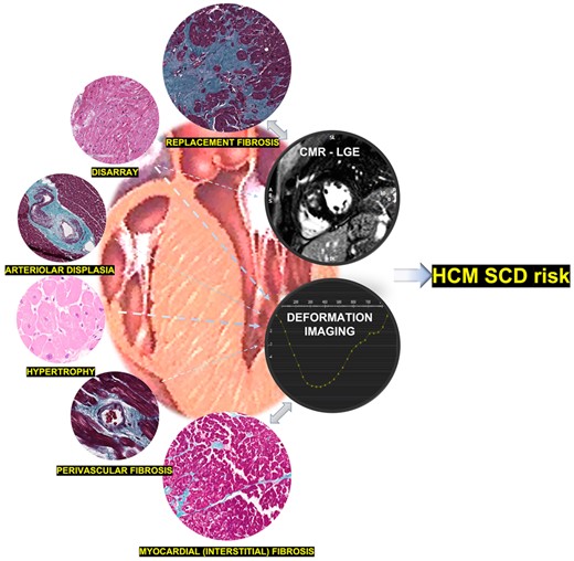 HCM-SCD risk scores should incorporate additional imaging markers (such as longitudinal strain and LGE analysis), based on distinct ultrastructural changes.