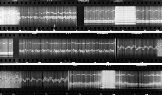 The first photographic film of M-mode echocardiography that was exposed by Edler and Hertz in October 1953, digitally scanned and then displayed as a continuous contact print. (courtesy of Professor Lars Edler)
