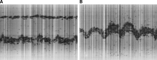 (A) frame 15; and (B) frame 19A; selected from the M-mode echocardiographic film of the heart (shown in Figure 1).