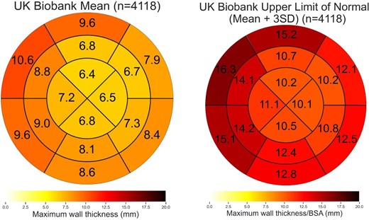 Healthy controls AHA maps (non-indexed)