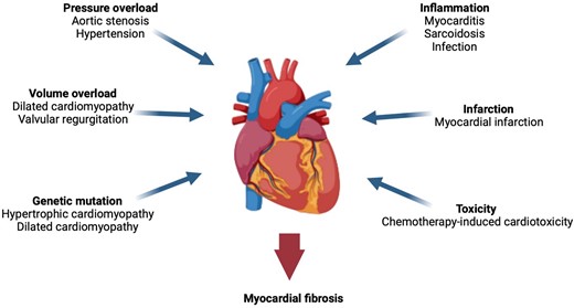Potential triggers for myocardial fibrosis. A variety of cardiovascular conditions can cause myocardial injury and induce fibrogenesis within the myocardium.