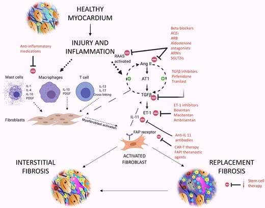 Potential therapeutic targets in myocardial fibrosis. Relevant pathways involved in fibrosis formation include Angiotensin-II, transforming growth factor-β, and interleukin-11 making them key treatment targets. Other targets include the renin–angiotensin–aldosterone system, sympathetic and immune systems, endothelin 1, stem cell therapy, CAR-T therapy, and theranostic FAP inhibitor agents. AngII, angiotensin-II; ACE-i, angiotensin-converting-enzyme inhibitors; ARB, angiotensin receptor blocker; ARNI, angiotensin receptor-neprilysin inhibitor; AT1, Angiotensin receptor; CAR-T, chimeric antigen receptor-modified T cells; ET-1, endothelin-1; FAPI, fibroblast activation protein inhibitor; FAP, fibroblast activation protein; IL, interleukin; PDGF, platelet-derived growth factor; RAAS, renin–angiotensin–aldosterone system; SGLT2i, sodium-glucose cotransporter-2 inhibitor; TGF-β, transforming growth factor (beta).