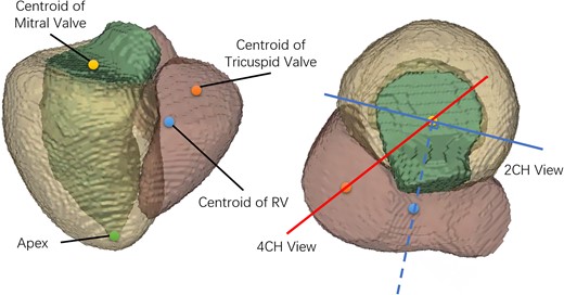 Definition of the 2CH and 4CH views. The green, yellow, and pink segments are LV, LV myocardium and RV. The yellow, orange, blue and green points are the centroid of mitral valve, the centroid of tricuspid valve, the centroid of RV and the apex. The solid red and blue lines indicate the 4CH and 2CH views visualized along the long axis. The solid blue line is perpendicular to the dotted blue line passing through the centroids of RV and mitral valve.