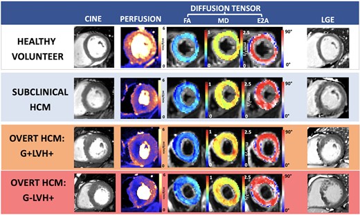 Figure 1: DTI & Perfusion maps