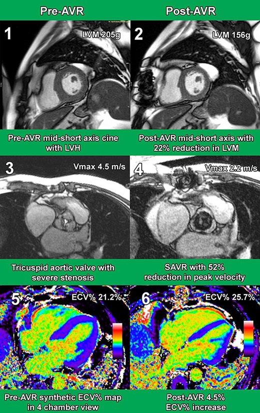 Exemplar Case CMR Images