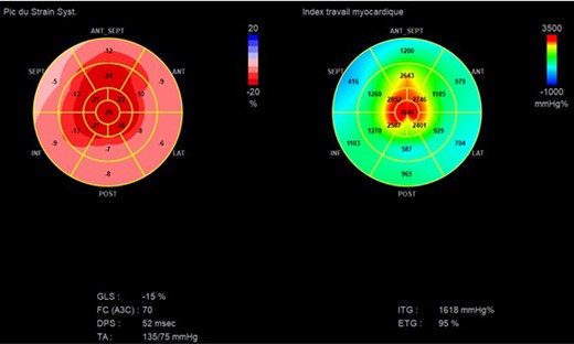 apical sparing and myocardial work