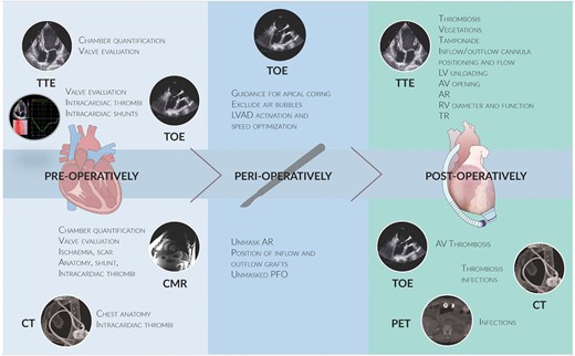 Use of multimodality imaging for pre-operative, peri-operative, and post-operative evaluation of patients with left ventricular assist devices. AR, aortic regurgitation; AV, aortic valve; CT, computed tomography; CMR, cardiac magnetic resonance; LV, left ventricular; LVAD, left ventricular assist device; PET, positron emission tomography; PFO, patent foramen ovale; RV, right ventricular; TOE, transoesophageal echocardiography; TR, tricuspid regurgitation; TTE, transthoracic echocardiography.