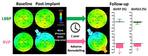 LBBP preserved LV work homogeneity and function better than RVP shortly after device implantation and during follow-up. The panels illustrate how two different pacing modalities affected LV work asymmetry differently. At baseline, the regional work was homogeneously distributed in each group. After device implantation, the myocardial work was immediately markedly reduced in septum (blue arrow) and later also mildly elevated in the lateral region (orange arrow) in RVP patients but remained stable in the LBBP group. Bar graphs: After 1 year follow-up, LBBP has less reduction in LVEF and LVGLS compared with RVP, even after adjusting for baseline LVEF or LVGLS, pacing mode, and valvular disease. ΔLVEF/ΔLVGLS, change in LV ejection fraction/global longitudinal strain from baseline to follow-up; LBBP, left bundle branch pacing; RVP, right ventricular pacing; LV, left ventricular; LVEF, LV ejection fraction; LVGLS, LV global longitudinal strain. *P < 0.01 vs. LBBP; †P < 0.01 vs. baseline.