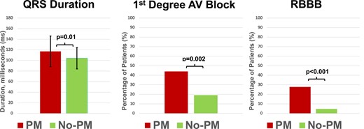 Comparison of PM and no PM groups for electrocardiographic parameters. Left panel: pre-TAVI mean QRS duration is significantly longer in the PM group compared to no PM group. Mid panel: pre-TAVI first-degree AVB is significantly more frequent in patients in need for PM. Right panel: RBBB is significantly more frequent in the PM group.