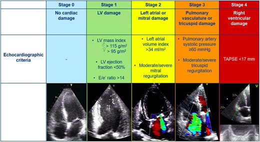 Stages of cardiac damage in severe aortic stenosis. The Figure illustrates the echocardiographic-based cardiac damage staging system that was applied before and after TAVI. LV, left ventricular; TAPSE, tricuspid annular plane systolic excursion; TAVI, transcatheter aortic valve implantation.
