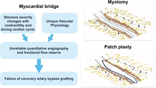 Edit Filter Menu Options Patch plasty of the left anterior descending artery as a practical ...