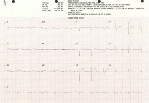 Electrocardiogram.