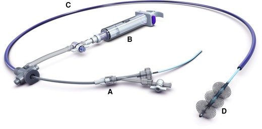 The Inari Medical FlowTriever system, comprised of a vascular introducer (A), a large-bore syringe for aspiration (B), a single trackable catheter (C), and nitinol mesh discs at the terminal end (D) to directly engage the clot or vegetation. Permission was obtained from Inari Medical for the reproduction of the schematic image of the FlowTriever® System for publication in this manuscript. Inari Medical retains the copyright to the above image per USC Title 17.
