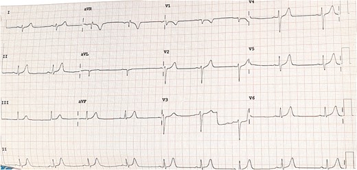 Electrocardiogram.
