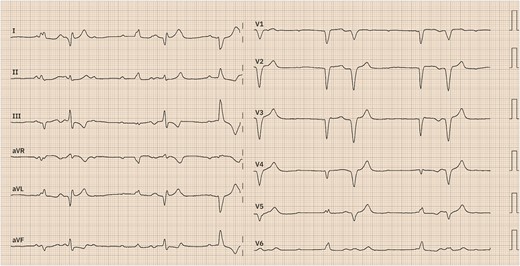 Electrocardiogram.