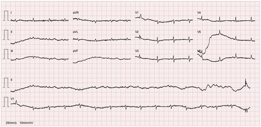 Electrocardiogram.