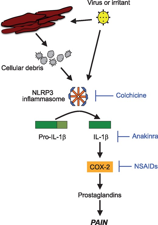 Interleukin-1 and the pathophysiology of pericarditis. An injury due to an infectious or non-infectious irritant triggers the formation of the NLRP3 inflammasome. The NLRP3 inflammasone subsequently initiates a local and systemic inflammatory response through activation and release of Interleukin-1.