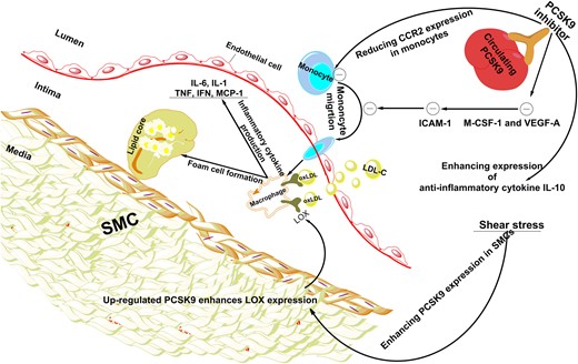 The effect of PCSK9 and PCSK9 inhibition on vascular inflammation. Shear stress results in the elevated expression of PCSK9 in SMCs. Up-regulated PCSK9 leads to the increased expression of LOX-1 in adjacent cells such as macrophages, which enhances oxLDL uptake and consequently promotes foam cell formation in the subendothelial layer. In addition, PCSK9 could enhance monocyte migration through elevating CCR2 expression. To sum up, over expression of PCSK9 causes vascular inflammation. On the other hand, PCSK9 inhibition could decrease main markers of vascular inflammation including M-CSF-1 and VEGF-A which leads to reduced ICAM-1 expression in endothelial cells and reduced infiltration of monocytes into the subendothelial layer. Furthermore, PCSK9 inhibition reduces CCR2 expression, which results in the inhibition of monocyte migration. Besides reduction of pro-inflammatory mediators, PCSK9 inhibitors could ameliorate vascular inflammation through elevating anti-inflammatory cytokines such as IL-10. CCR2, C–C chemokine receptor Type 2; ICAM-1, intercellular adhesion molecule 1; IFN-γ, interferon gamma; IL-1, interleukin 1; IL-6, interleukin 6; IL-10, interleukin 10; LDL-C, low-density lipoprotein cholesterol; LOX-1, lectin-like oxidized LDL receptor-1; M-CSF-1, major histocompatibility complex; oxLDL, oxidized low-density lipoprotein; PCSK9, proprotein convertase subtilisin/kexin Type 9; SMCs, smooth muscle cells; TNF-α, tumour necrosis factor alpha; VEGF-A, vascular endothelial growth factor A.