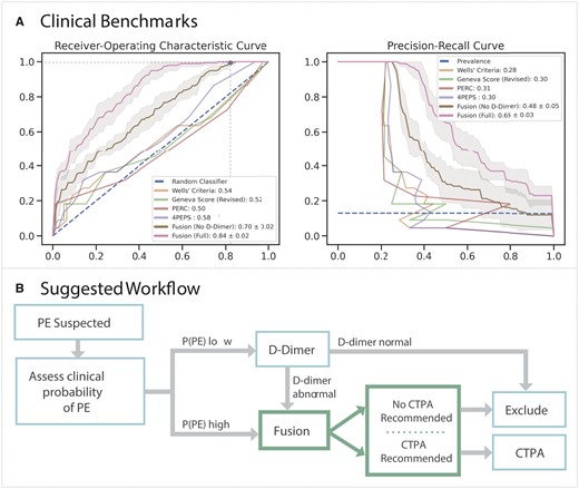 Clinical benchmark and integration. (A) Mean receiver-operating characteristic (ROC, left) and precision-recall (PRC, right) curves with 95% confidence intervals for the Fusion model with (pink) and without (brown) D-dimer, whereas ROC and PRC are shown for the clinical scores—Wells’ Criteria (yellow), Revise Geneva Score (green), PERC (red), and 4PEPS (purple). In top plot, the horizontal and vertical lines correspond to optimal threshold. Mean and standard deviations for the area under each respective curve (AUROC, AUPRC) for the Fusion models are displayed in the legend, whereas area under each respective curve (AUROC, AUPRC) are shown for the clinical scores. (B) The Fusion model may be used to recommend computed tomography pulmonary angiogram or exclude pulmonary embolism in patients with moderate to high likelihood of pulmonary embolism after clinical stratification or those at low suspicion with an abnormal D-dimer.
