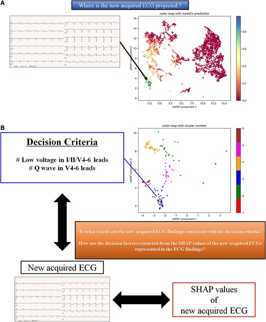 An example of how our model could be used in clinical practice, focusing on interpretability. (A) This figure shows where the two-dimensional SHAP values of a newly acquired ECG are projected onto the colour-mapping of the two-dimensional SHAP values for the test dataset according to the LVEF values of each data item. For example, in this figure, the newly acquired ECG is projected onto the location indicated by a star. We can approximately identify the LVEF values of patients with similar decision criteria to the newly acquired ECG. (B) This figure shows how to use the clustered two-dimensional SHAP values and the SHAP values of the newly acquired ECG when the model predicts that the newly acquired ECG is a reduced LVEF patient. For example, if the newly acquired ECG is projected to a star position in the clustered two-dimensional SHAP values, it can be recognized to which cluster it is likely to belong. From the SHAP values of the newly acquired ECG, decision factors indicating the ECG parameters that the model considers important for this ECG can be extracted. By referring to the interpreted decision criteria in the cluster and the extracted decision factors of the newly acquired ECG, we may be able to understand the ECG findings that seem to indicate reduced LVEF, as expressed in the newly acquired ECG. UMAP, uniform manifold approximation and projection; SHAP, Shapley additive explanations.