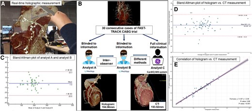 Study workflow and results. Panel A shows an example of real-time measurements on holographic reconstructions with hand gestures and voice commands. Panel B shows the study workflow. Thirty consecutive FAST TRACK CABG trial cases were analyzed using the traditional CT workstation or 3D holograms. An example was provided in the lower panel. Panel C shows the Bland-Altman plot of the holographic graft length measurement in the first 20 cases by two analysts. Panel D shows the Bland-Altman plot of the graft length measurement by hologram vs. CT system. Panel E shows the correlation between the holographic and traditional CT system measurements.