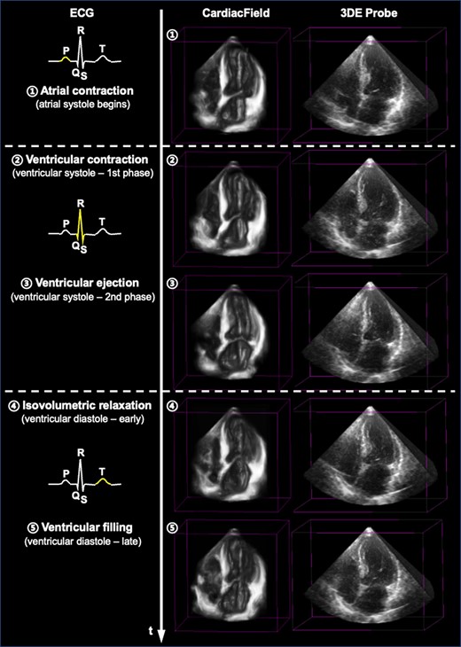 A three-dimensional dynamic heart within one cardiac cycle. We show some snapshots of a reconstructed three-dimensional dynamic heart within one cardiac cycle using CardiacField, compared with that acquired by the three-dimensional echocardiography probe. The electrocardiogram is used to indicate the phases within one cardiac cycle.