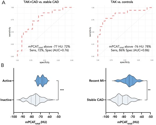 Diagnostic accuracy of PCAT density in TAK. Receiver operating characteristic curves showing the diagnostic accuracy of PCAT density for differentiating (A) patients with TAK and CAD from stable atherosclerotic CAD, and patients with TAK and no CAD from control subjects. (B) Violin plots [dashed lines: median (interquartile range)] showing the distribution of PCAT density in patients with active versus inactive TAK, and recent MI vs. stable atherosclerotic CAD. CAD, coronary artery disease; HU, Hounsfield Unit; MI, myocardial infarction; PCAT, pericoronary adipose tissue; TAK, Takayasu arteritis; ***P < 0.001; **P < 0.01.