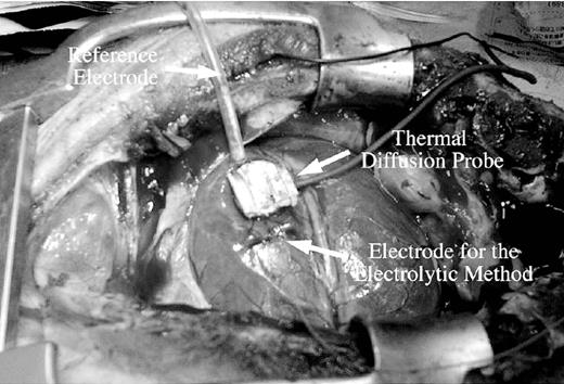 A thermal diffusion probe, an electrode and a reference electrode for the electrolytic hydrogen clearance method are set on the surface of a pig heart. The thermal diffusion probe was sutured on the heart at the anterior wall of the left ventricle at a point 2 cm distal from the first diagonal branch and 1 cm away from the left anterior descending coronary artery.