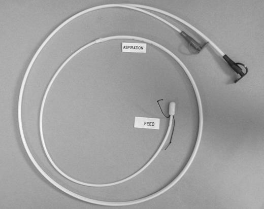 ‘Entrafeed 2’ double lumen naso-jejunal feeding/aspiration tube. It measures 110 cm in length, the feeding lumen having an internal diameter of 1.5 mm. The aspiration port has multiple side holes and is of larger calibre. There is a silk suture at the tip for grasping with endoscopic forceps, should it be necessary to insert the tube with a flexible gastroscope.