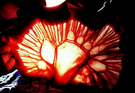 Transillumination technique of the mesenterium.