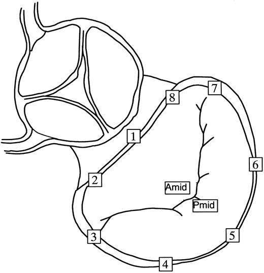 Radiopaque marker array used for the mitral annulus and leaflets. Markers were sutured to the mid-septal annulus (#1), left fibrous trigone (#2), anterior commissure (#3), left lateral annulus (#4), mid-lateral annulus (#5), right lateral annulus (#6), posterior commissure (#7) and right fibrous trigone (#8). What we defined here as the anatomic lateral mitral annulus is clinically termed the ‘posterior’ annulus. Markers were sutured to the AMID and PMID.