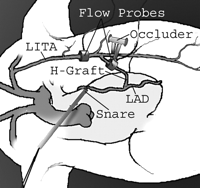 Schematics of the set-up used for the experiments. LAD=left anterior descending artery; and LITA=left internal thoracic artery.