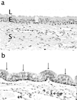 (a,b) Immunohistochemical detection of VEGF at 4 months postoperatively. Trachea from a control rabbit (a) and after autograft repair (b). Original magnification 400×. Open arrows indicate strong positivity of the epithelium for VEGF, and a closed arrow indicates strong VEGF positivity in plasmacells. * indicates trace positivity of the endothelium for VEGF. L, lumen; E, epithelium; S, subepithelium.