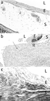 (a–c) Trachea from a rabbit 4 months after autograft repair (a) with a wide open lumen (L), no granulation tissue and minimal fibrosis in the epithelium (E) and subepithelium (S) (250×), as compared to that of a rabbit 2 months after stent insertion with granulation tissue (closed arrow) protruding into the lumen (b), and subepithelial fibrosis (*) in the saline zone (c) (400×). Elastica von Gieson staining.