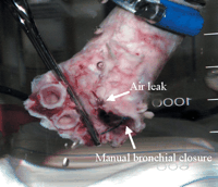 Air leak through the paries membranaceus of the bronchial stump with manual suture.