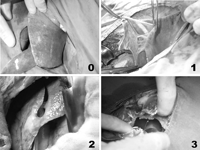 Scoring of pleural thickening and adhesion; (0) no change in visceral or parietal pleura, (1) mild pleural thickening or loose pleural adhesion, (2) moderate pleural thickening or firm pleural adhesion, (3) severe pleural thickening or firm pleural adhesion.