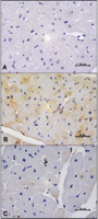 Representative photomicrographs of in situ hybridization of TNFα in left ventricular tissue at 8 h after CPB. (A) In situ hybridization with sense probe (negative control) in PLA group; (B) strong TNFα mRNA staining was revealed in cardiomyocytes of PLA with antisense probe; (c) less pronounced myocardial TNFα mRNA staining in MP group with antisense probe.