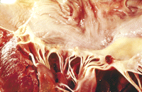 Demonstrates typical appearances of NBTE.