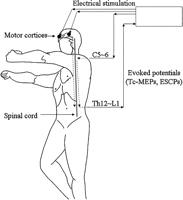 Monitoring of spinal cord evoked potentials. Direct transcranial electrical stimulation of the cerebral motor cortices was applied, and the transcranial motor-evoked potentials (Tc-MEPs) were recorded at the lumbar enlargement. The descending evoked spinal cord potentials (ESCPs) were also recorded at the lumbar enlargement after stimulation of the cervical spinal cord (C = cervical; Th = thoracic; L = lumbar).
