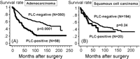 Overall survival curves according to intraoperative PLC status: Histology-based analysis. (A): Adenocarcinoma, (B) squamous cell carcinoma. Whereas PLC findings for patients with adenocarcinoma had a significantly strong impact on survival (p ≪ 0.0001), those for squamous cell carcinoma lacked prognostic value (p = 0.24).