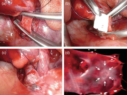 (a) Main trunks of PA were clamped and a PA hole was created. (b) TC was applied to cover the hole. (c) Five minutes after the TC application. (d) Intravascular lumen findings at 8 weeks. Repaired site (arrow) shows just a fine trace at the incision site.