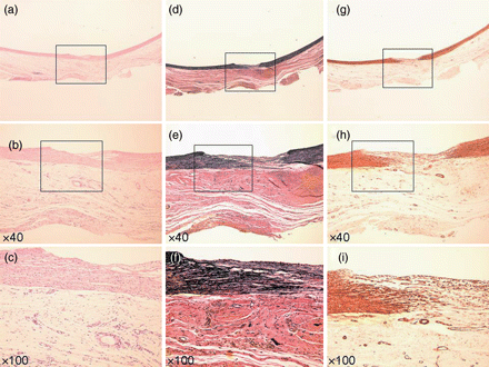 Specimen at 4 weeks. (a–c) Haematoxylin–eosin stain. (d–f) EVG stain. (g–i) α-SMA stain. (a, d and g) Loupe. (b, e and h) ×40 Magnification. (c, f and i) ×100 Magnification. Elastic fibre (e) and smooth muscle fibre (h) began to invade the defect between the endothelial layer and TC. Inflammatory cells remained in the defect (c).