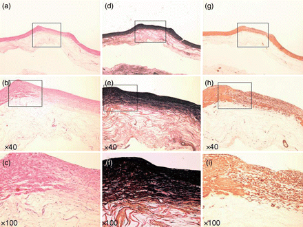 Specimen at 8 weeks. (a–c) Haematoxylin–eosin stain. (d–f) EVG stain. (g–i) α-SMA stain. (a, d and g) Loupe. (b, e and h) ×40 Magnification. (c, f and i) ×100 Magnification. Three-layer construction completely regenerated (b, c and h).