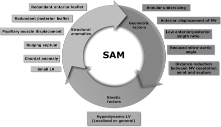 Factors predisposing to SAM. LV: left ventricle; MV: mitral valve.
