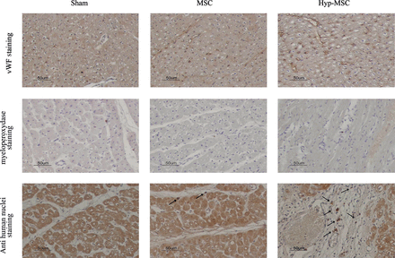 Histological analysis. Endothelial cells (vWF), inflammatory cells (myeloperoxydase) and MSC (human anti-nuclei antibody) staining. Arrows indicate viable transplanted MSC in the ischaemic zone.