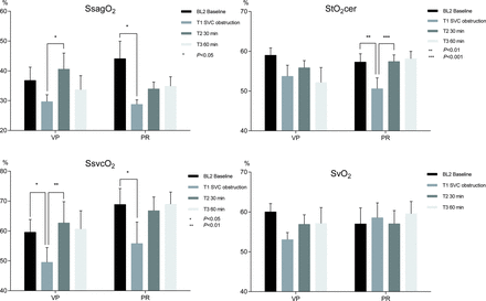 Sagittal sinus oxygen saturation, regional cerebral tissue oxygenation saturation, SVC oxygen saturation and mixed venous oxygen saturation in pigs during 34°C experimental CPB, with SVC obstruction and interventions in the form of VP respective PR of congestion. Means and SEMs. StO2cer, SsvcO2 and SsagO2 were significantly lowered by SVC obstruction (all pigs). Both intervention techniques increased all three variables (StO2cer: VP P = 0.1868, PR P = 0.0011; SsvcO2: VP P = 0.0064, PR P = 0.0669; SsagO2: VP P = 0.0385, PR P = 0.1163), whereas the SvO2 results were inconsistent. PR: partial relief of congestion; SsagO2: sagittal sinus oxygen saturation; SsvcO2: SVC oxygen saturation; StO2cer: cerebral tissue oxygen saturation index; SvO2: mixed venous oxygen saturation; VP: vasopressor treatment.