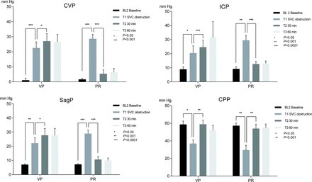 CVP, ICP, SagP and CPP in pigs during 34°C experimental CPB, with SVC obstruction and interventions in the form of VP respective PR of congestion. Means and SEMs. SVC obstruction caused a significant increase in CVP, ICP and SagP, and a corresponding decrease in the CPP. Both intervention methods restored CPP to baseline levels. Elevated pressures persisted in the VP group. CPP: cerebral perfusion pressure; CVP: central venous pressure; ICP: intracranial pressure; PR: partial relief of congestion; SagP: sagittal sinus pressure; VP: vasopressor treatment.